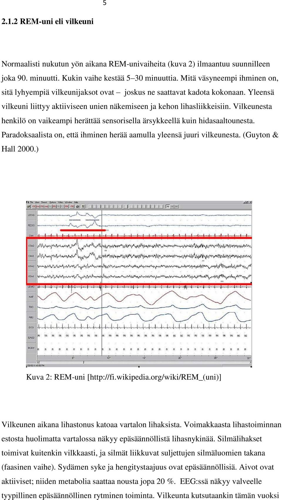 Vilkeunesta henkilö on vaikeampi herättää sensorisella ärsykkeellä kuin hidasaaltounesta. Paradoksaalista on, että ihminen herää aamulla yleensä juuri vilkeunesta. (Guyton & Hall 2000.