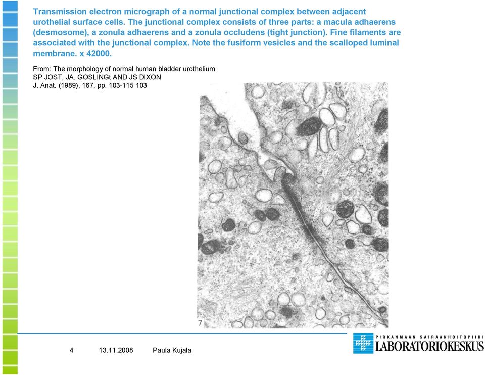 (tight junction). Fine filaments are associated with the junctional complex.