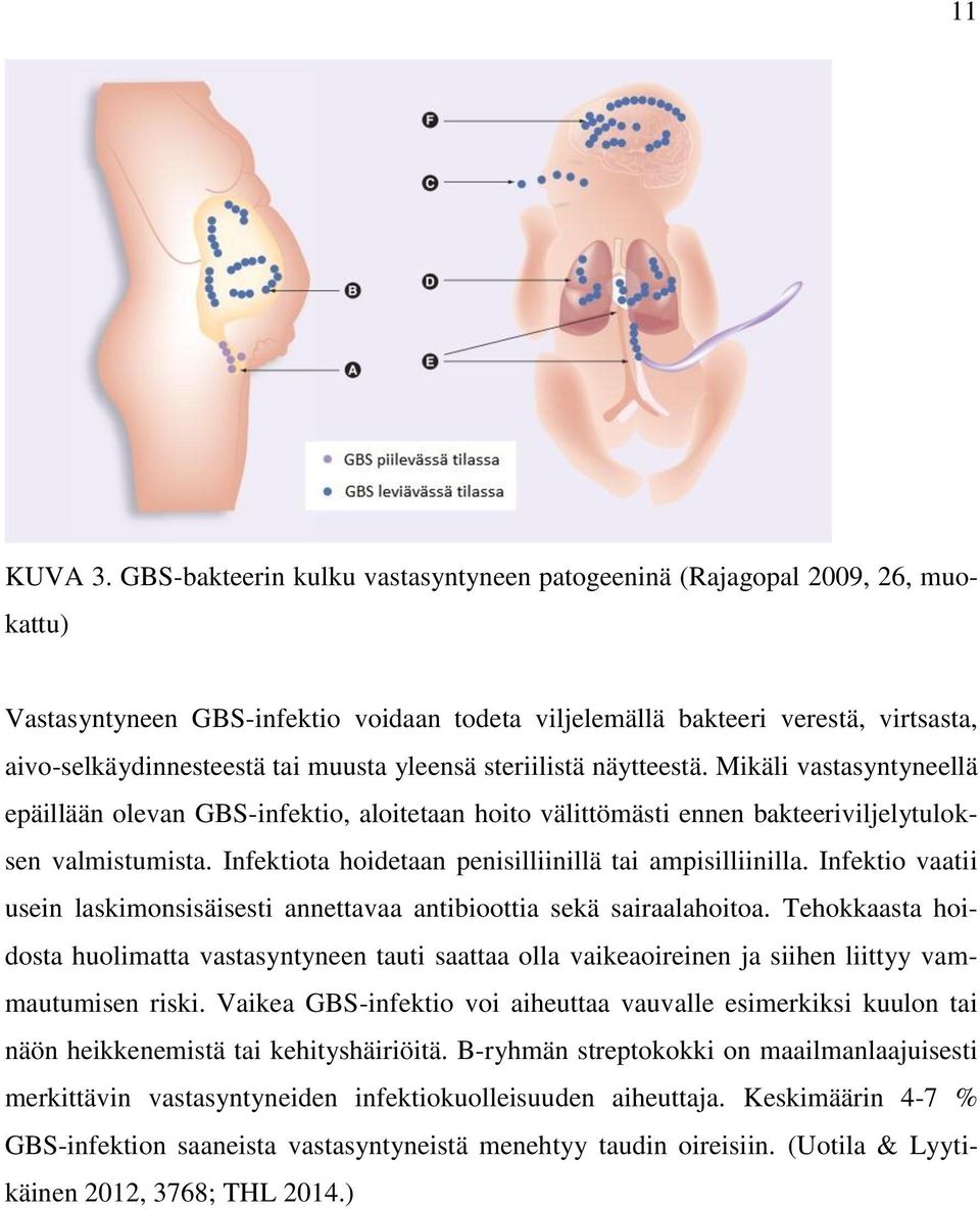 yleensä steriilistä näytteestä. Mikäli vastasyntyneellä epäillään olevan GBS-infektio, aloitetaan hoito välittömästi ennen bakteeriviljelytuloksen valmistumista.