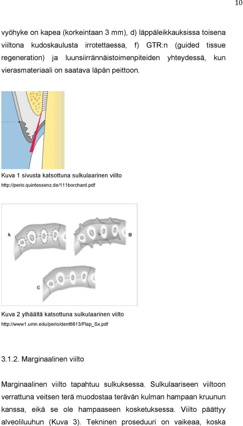 pdf Kuva 2 ylhäältä katsottuna sulkulaarinen viilto http://www1.umn.edu/perio/dent6613/flap_sx.pdf 3.1.2. Marginaalinen viilto Marginaalinen viilto tapahtuu sulkuksessa.