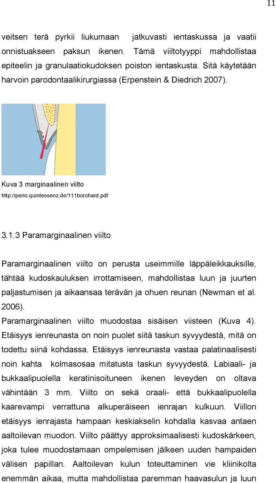 1borchard.pdf 3.1.3 Paramarginaalinen viilto Paramarginaalinen viilto on perusta useimmille läppäleikkauksille, tähtää kudoskauluksen irrottamiseen, mahdollistaa luun ja juurten paljastumisen ja