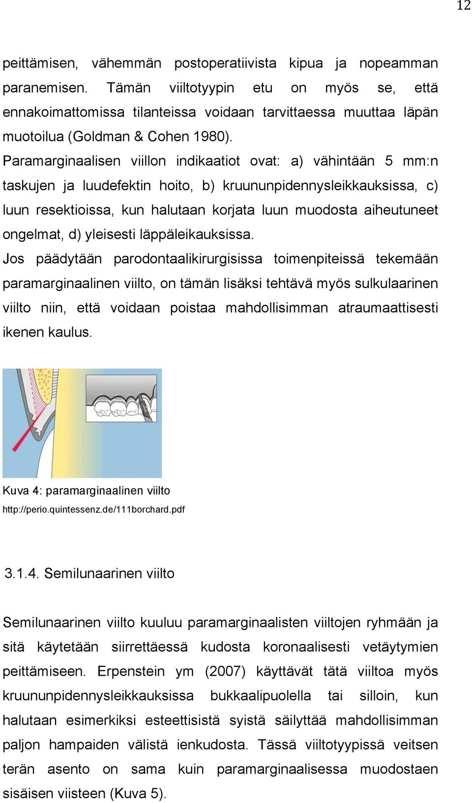 Paramarginaalisen viillon indikaatiot ovat: a) vähintään 5 mm:n taskujen ja luudefektin hoito, b) kruununpidennysleikkauksissa, c) luun resektioissa, kun halutaan korjata luun muodosta aiheutuneet