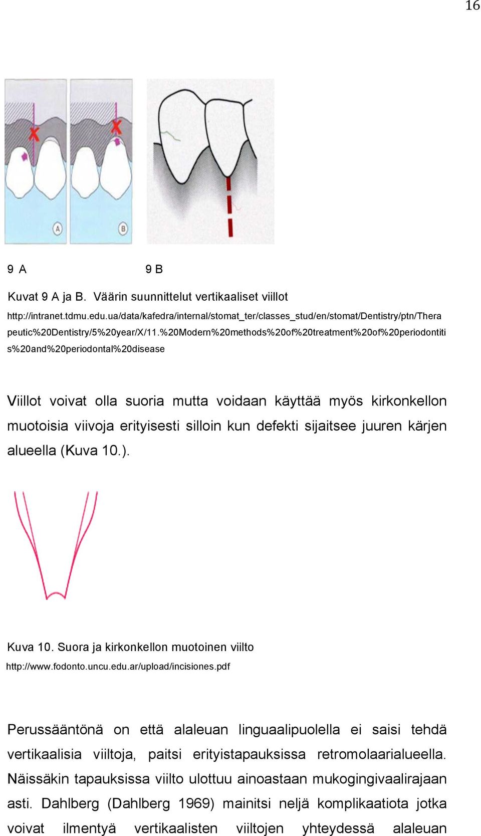 %20modern%20methods%20of%20treatment%20of%20periodontiti s%20and%20periodontal%20disease Viillot voivat olla suoria mutta voidaan käyttää myös kirkonkellon muotoisia viivoja erityisesti silloin kun