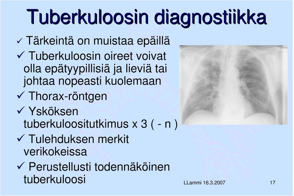 Thorax-röntgen Ysköksen tuberkuloositutkimus x 3 ( - n ) Tulehduksen