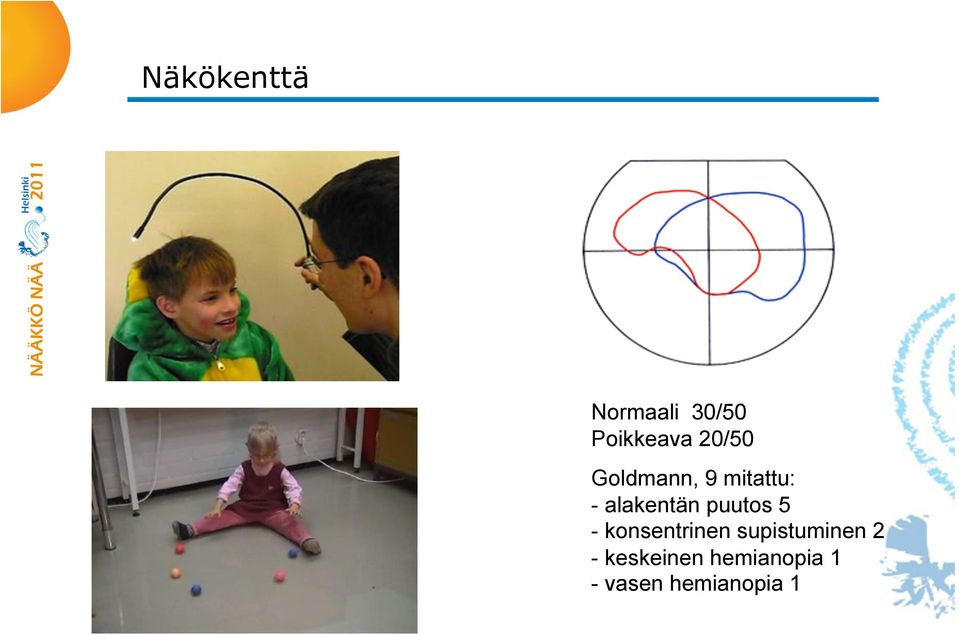 puutos 5 - konsentrinen supistuminen 2