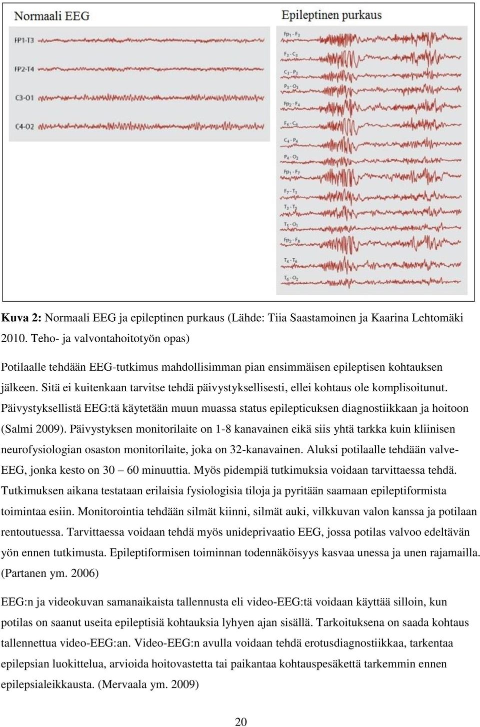 Sitä ei kuitenkaan tarvitse tehdä päivystyksellisesti, ellei kohtaus ole komplisoitunut. Päivystyksellistä EEG:tä käytetään muun muassa status epilepticuksen diagnostiikkaan ja hoitoon (Salmi 2009).