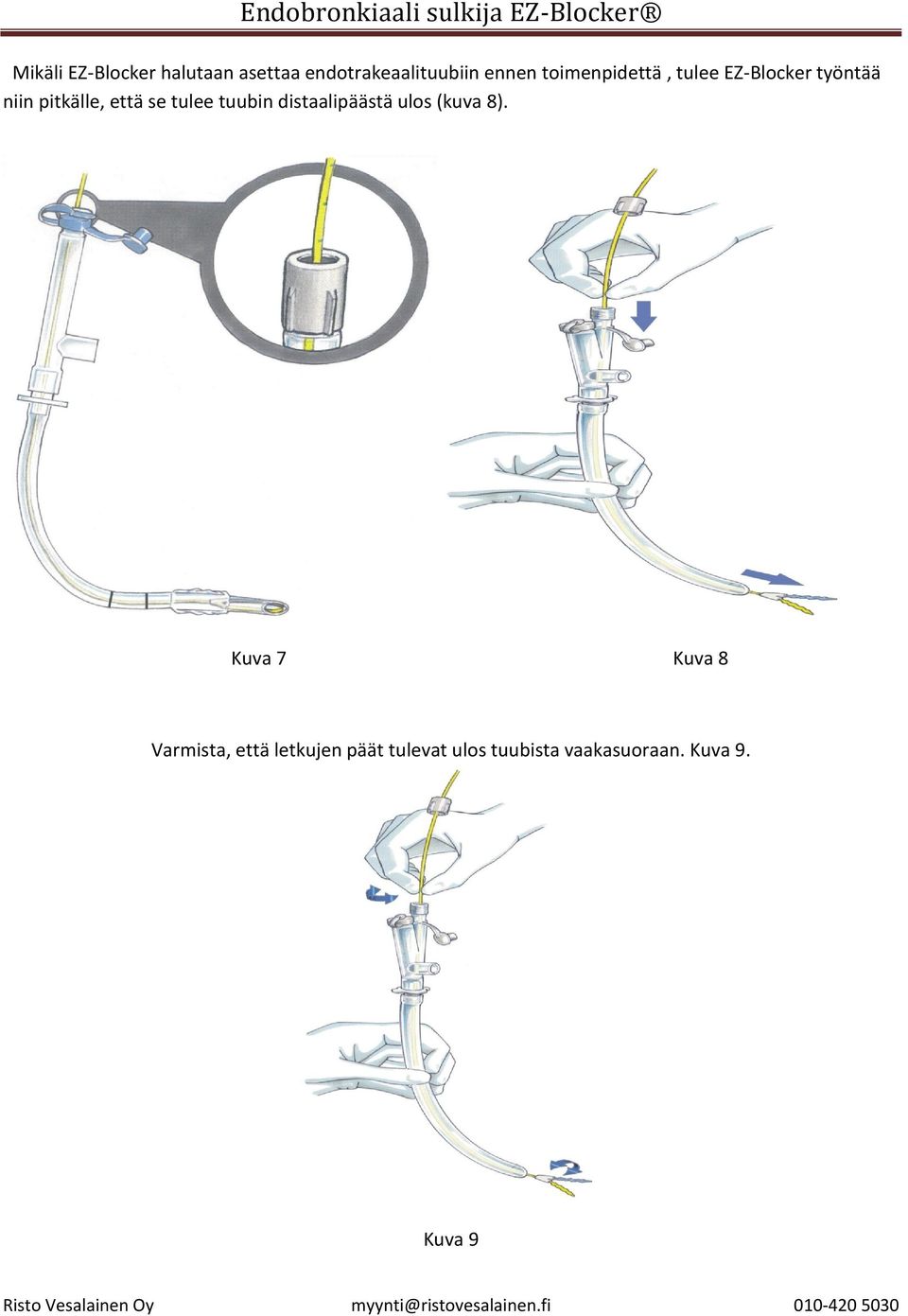 tulee tuubin distaalipäästä ulos (kuva 8).