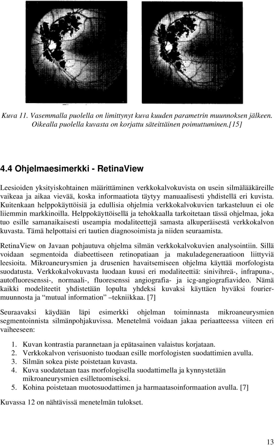 eri kuvista. Kuitenkaan helppokäyttöisiä ja edullisia ohjelmia verkkokalvokuvien tarkasteluun ei ole liiemmin markkinoilla.