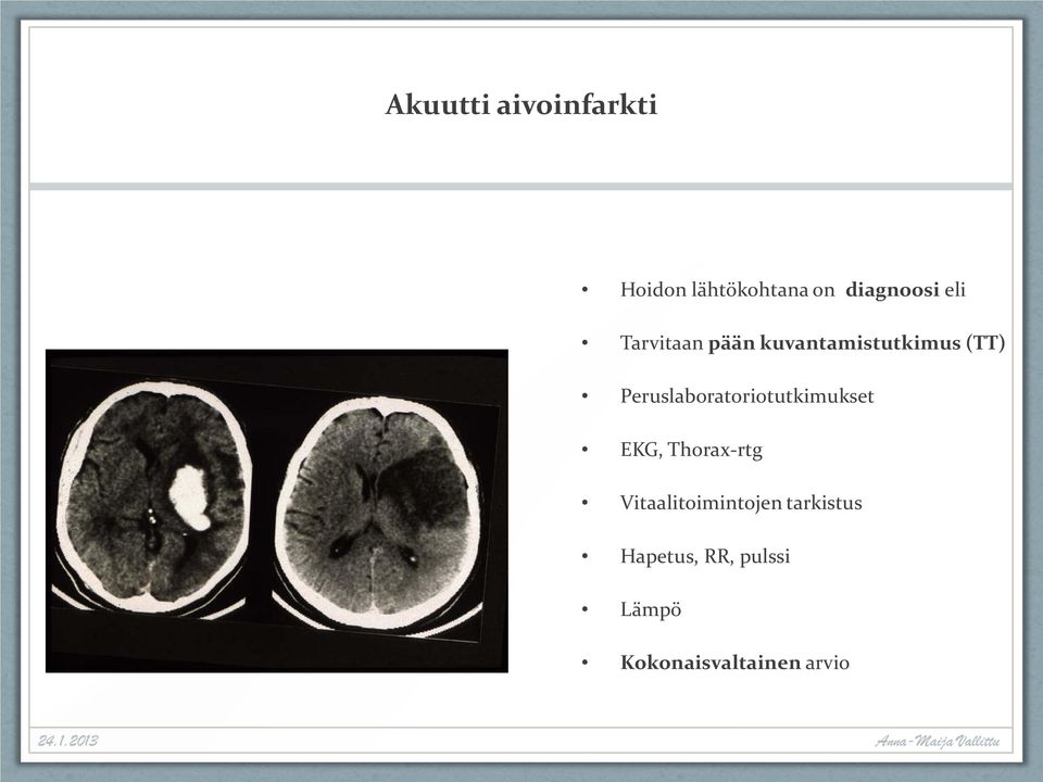 Peruslaboratoriotutkimukset EKG, Thorax-rtg