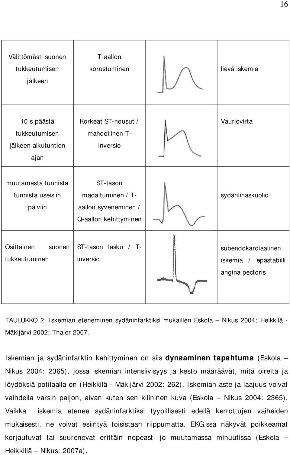 subendokardiaalinen iskemia / epästabiili angina pectoris TAULUKKO 2. Iskemian eteneminen sydäninfarktiksi mukaillen Eskola Nikus 24; Heikkilä - Mäkijärvi 22; Thaler 27.