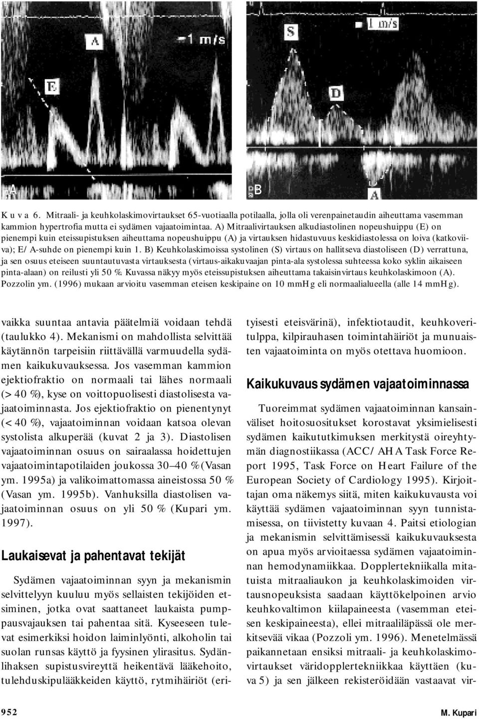 1. B) Keuhkolaskimoissa systolinen (S) virtaus hallitseva diastoliseen (D) verrattuna, ja sen osuus etseen suuntautuvasta virtauksesta (virtaus-aikakuvaajan pinta-ala systolessa suhteessa koko syklin