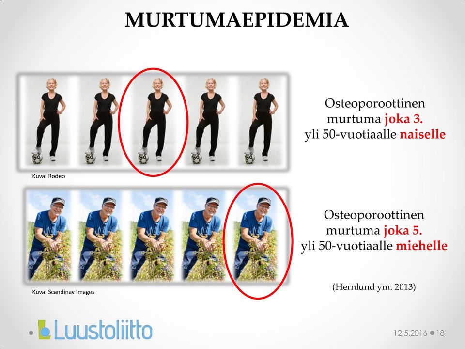 Osteoporoottinen murtuma joka 5.