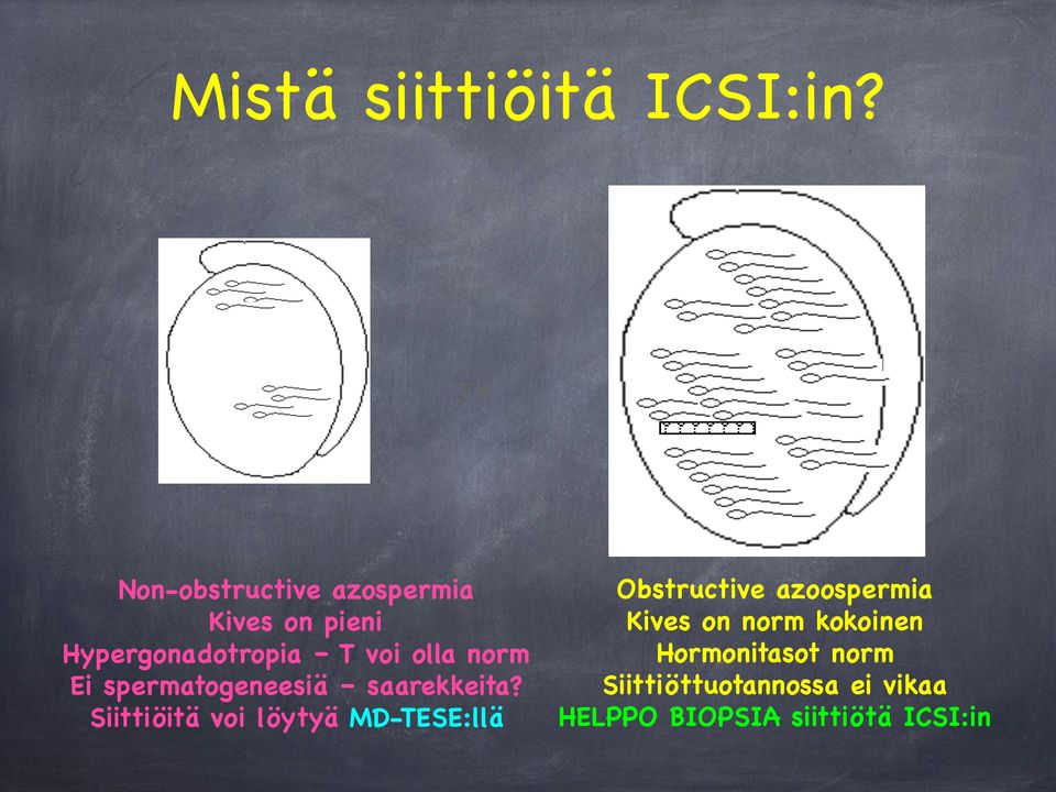 norm Ei spermatogeneesiä saarekkeita?