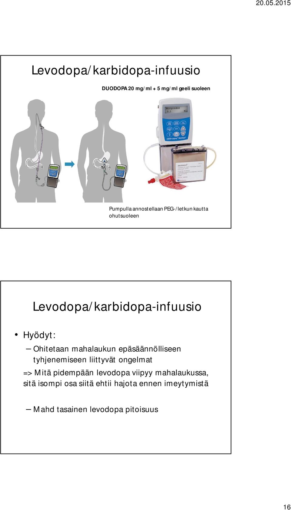 epäsäännölliseen tyhjenemiseen liittyvät ongelmat => Mitä pidempään levodopa viipyy