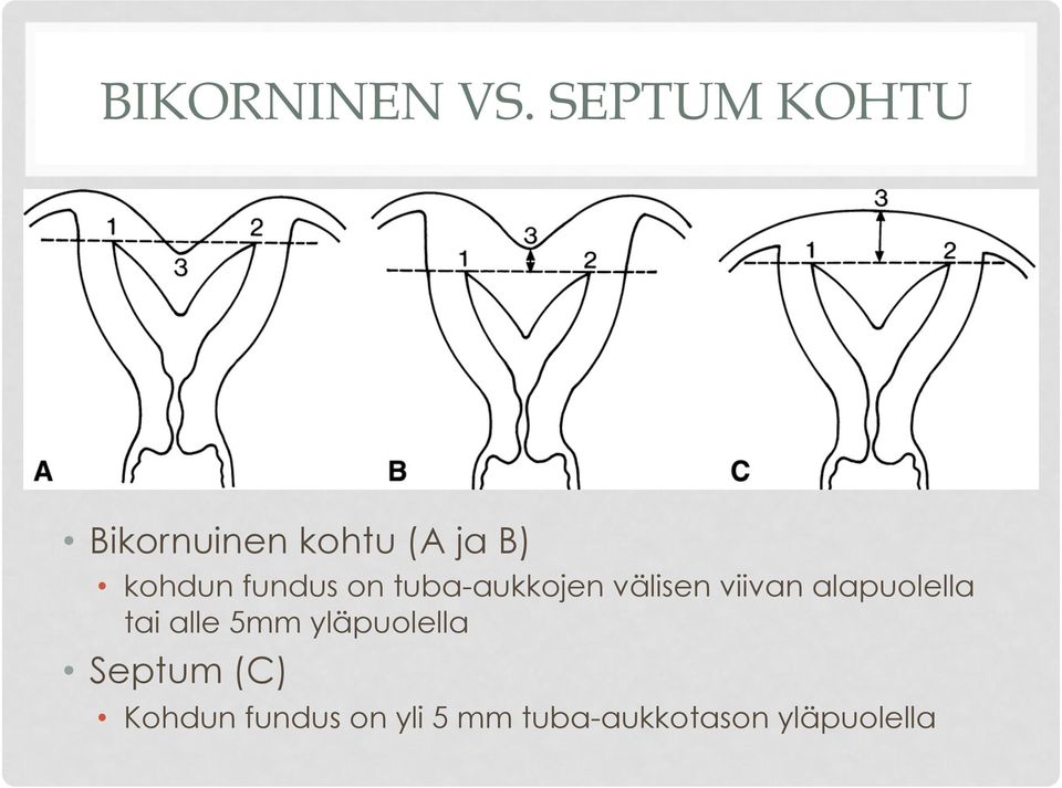 fundus on tuba-aukkojen välisen viivan alapuolella