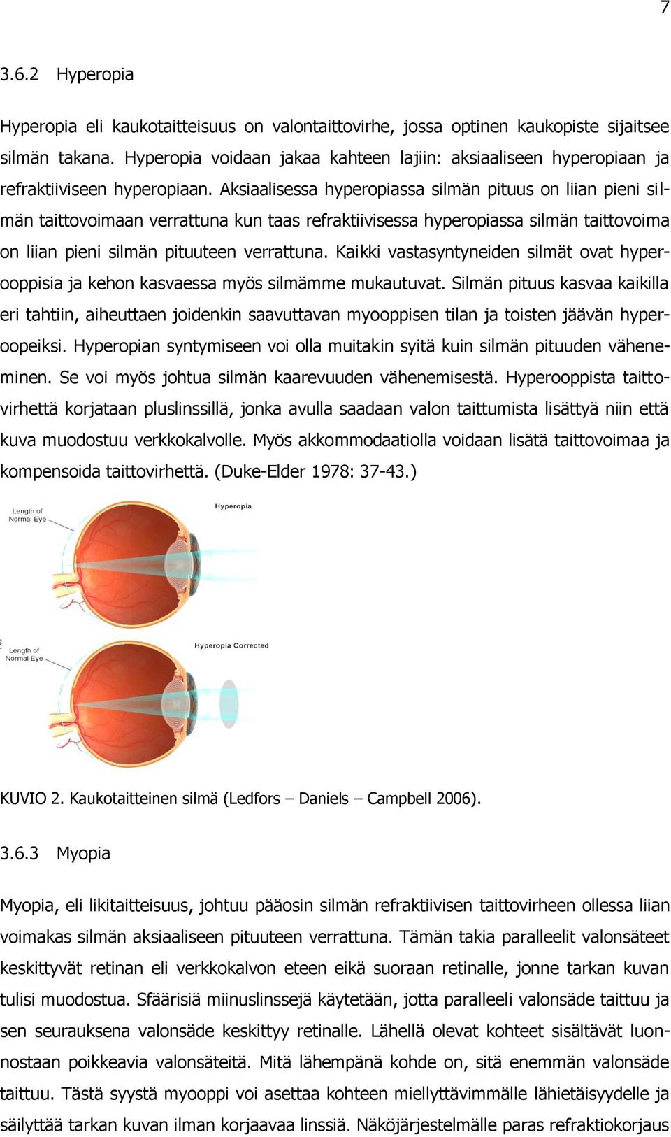 Aksiaalisessa hyperopiassa silmän pituus on liian pieni silmän taittovoimaan verrattuna kun taas refraktiivisessa hyperopiassa silmän taittovoima on liian pieni silmän pituuteen verrattuna.