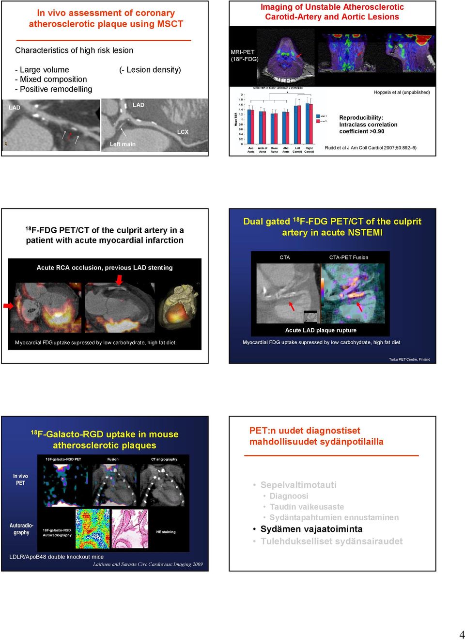 9 Left main Turku Centre Rudd et al J Am Coll Cardiol 7;5:89 6) F-FDG /CT of the culprit artery in a patient with acute myocardial infarction Dual gated F-FDG /CT of the culprit artery in acute