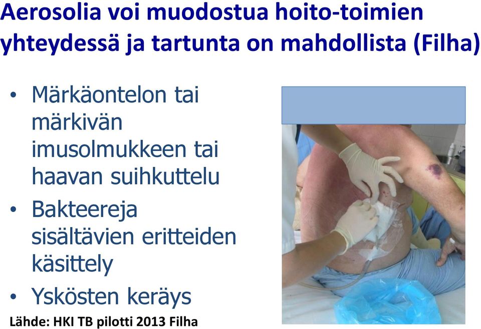 imusolmukkeen tai haavan suihkuttelu Bakteereja sisältävien