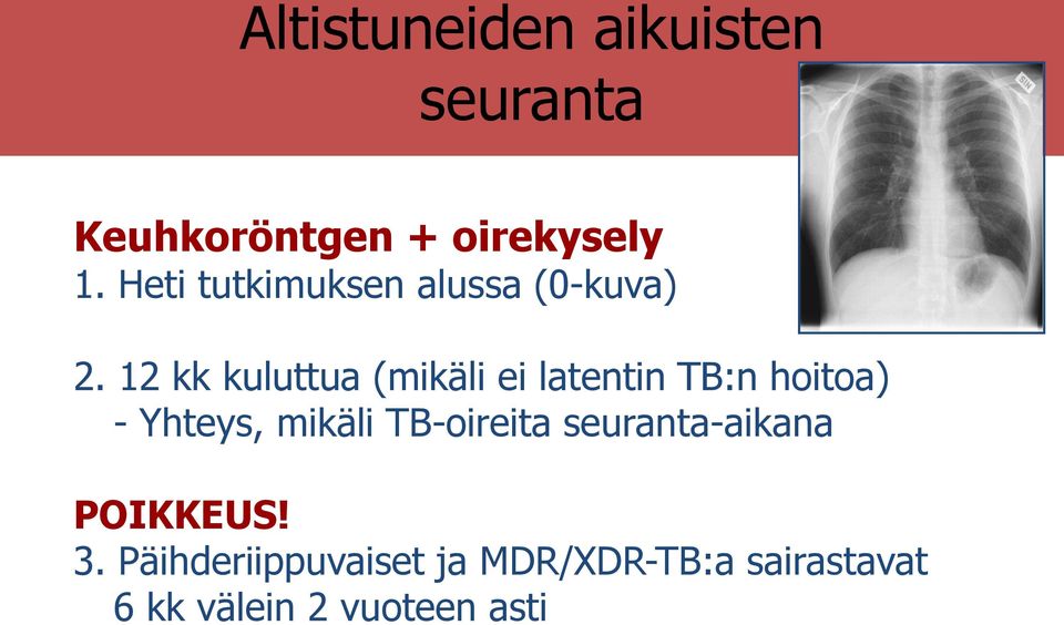 12 kk kuluttua (mikäli ei latentin TB:n hoitoa) - Yhteys, mikäli