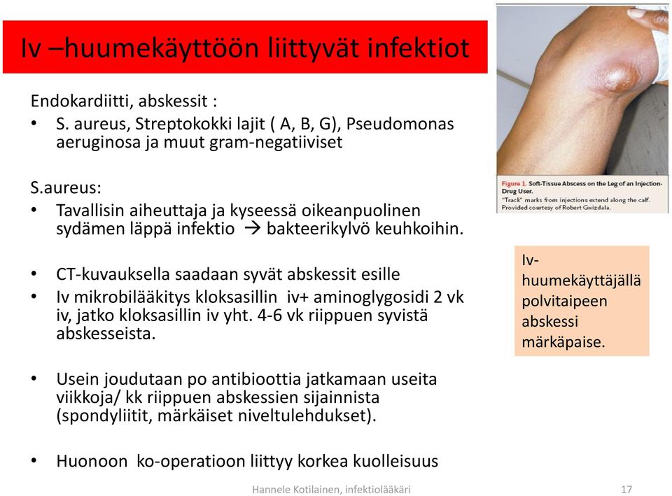 CT-kuvauksella saadaan syvät abskessit esille Iv mikrobilääkitys kloksasillin iv+ aminoglygosidi 2 vk iv, jatko kloksasillin iv yht. 4-6 vk riippuen syvistä abskesseista.