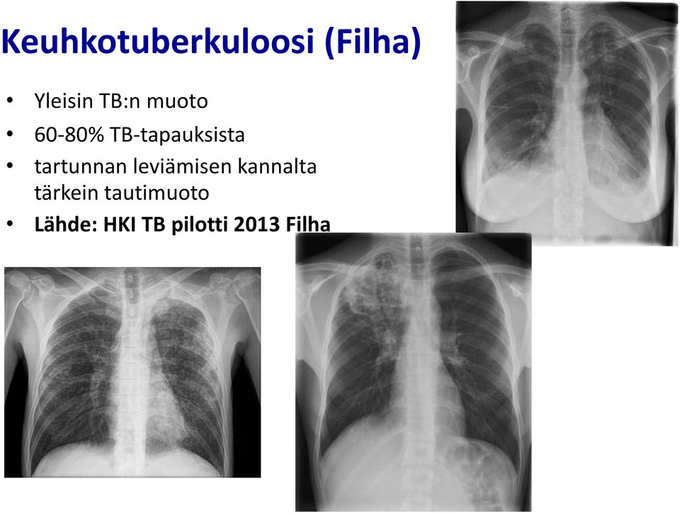 tartunnan leviämisen kannalta tärkein