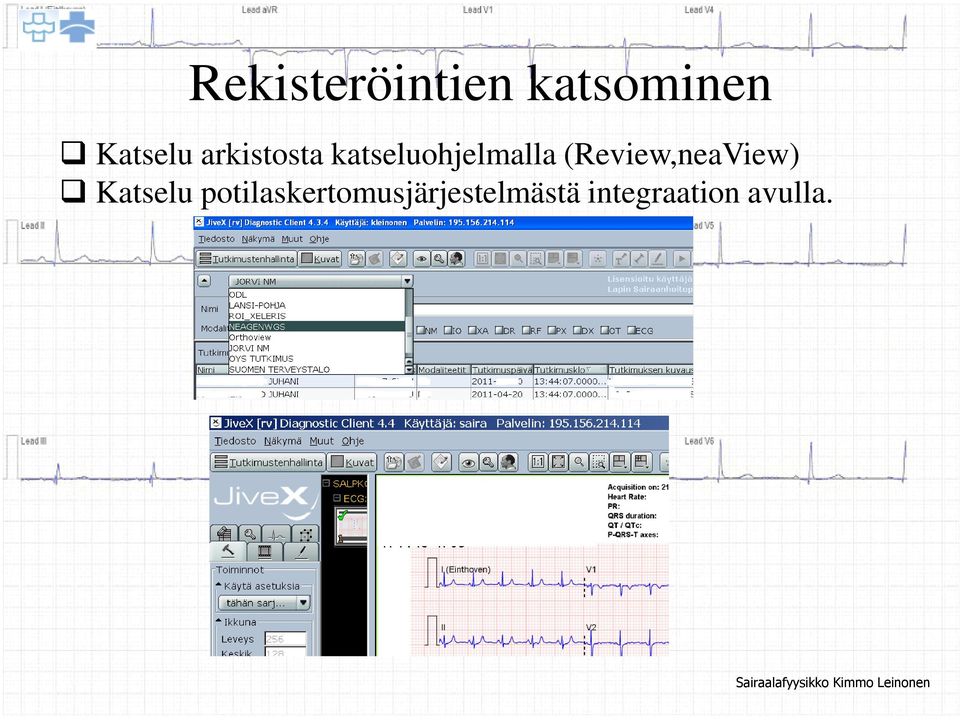 (Review,neaView) Katselu