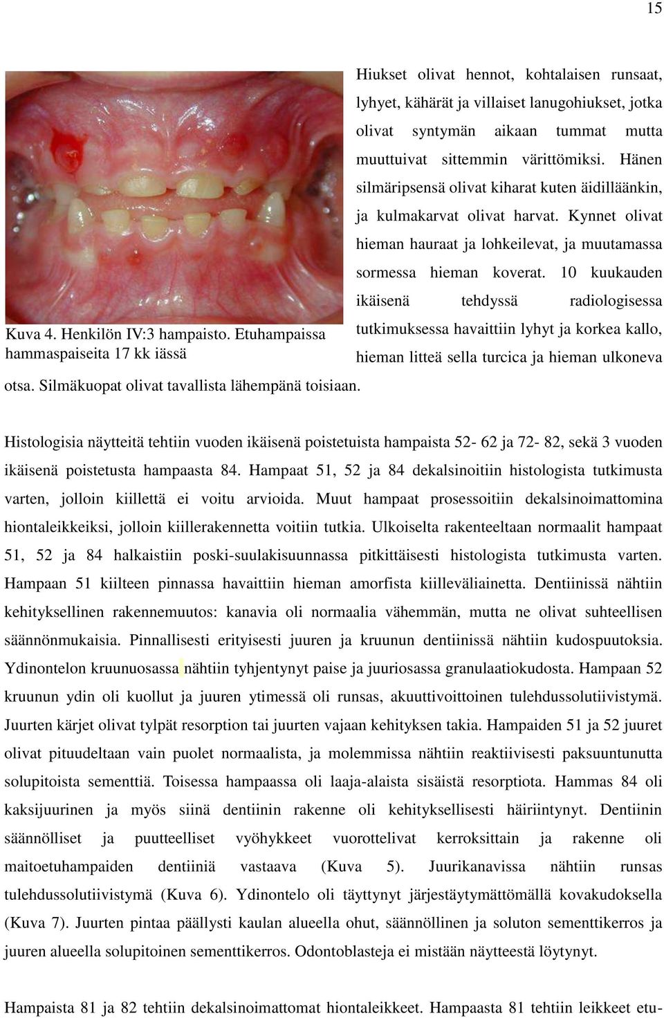 Hänen silmäripsensä olivat kiharat kuten äidilläänkin, ja kulmakarvat olivat harvat. Kynnet olivat hieman hauraat ja lohkeilevat, ja muutamassa sormessa hieman koverat.