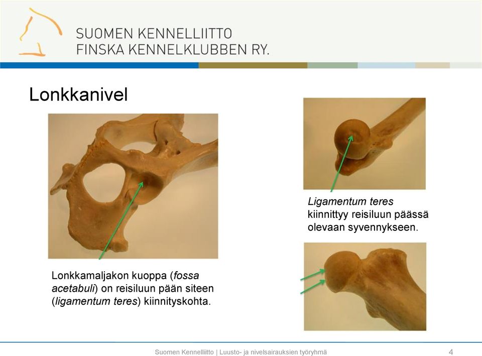 Lonkkamaljakon kuoppa (fossa acetabuli) on