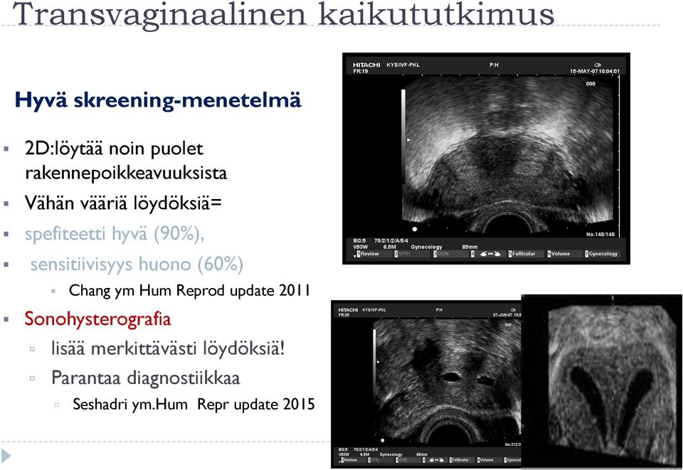 sensitiivisyys huono (60%) Chang ym Hum Reprod update 2011 Sonohysterografia ú ú