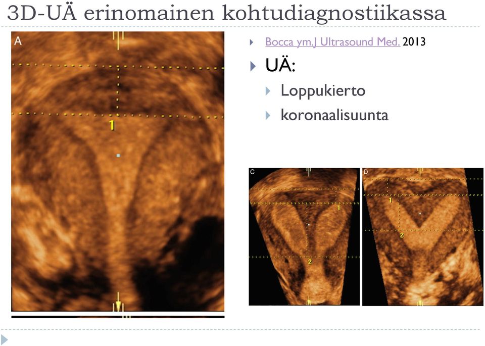 Bocca ym.j Ultrasound Med.