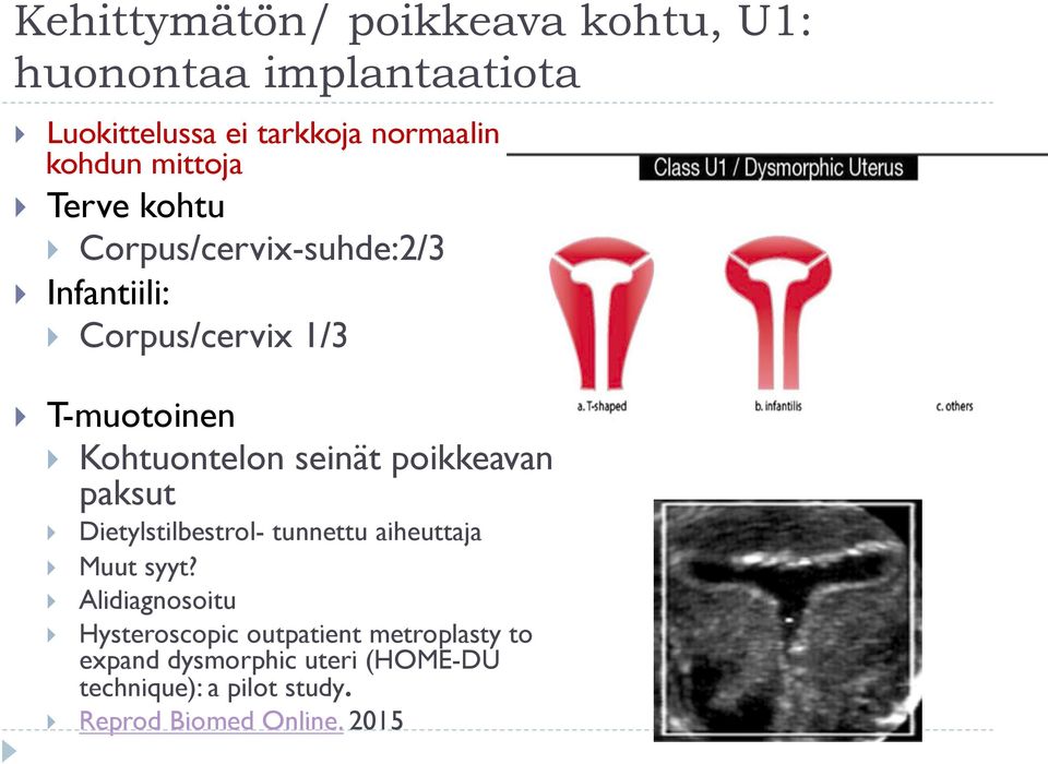 seinät poikkeavan paksut Dietylstilbestrol- tunnettu aiheuttaja Muut syyt?