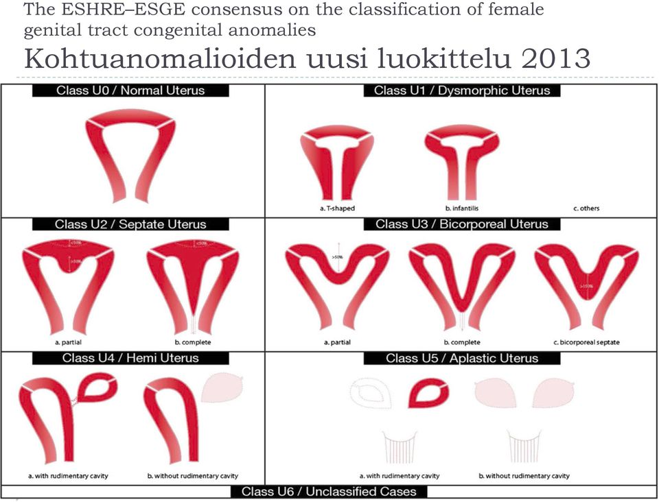 tract congenital anomalies