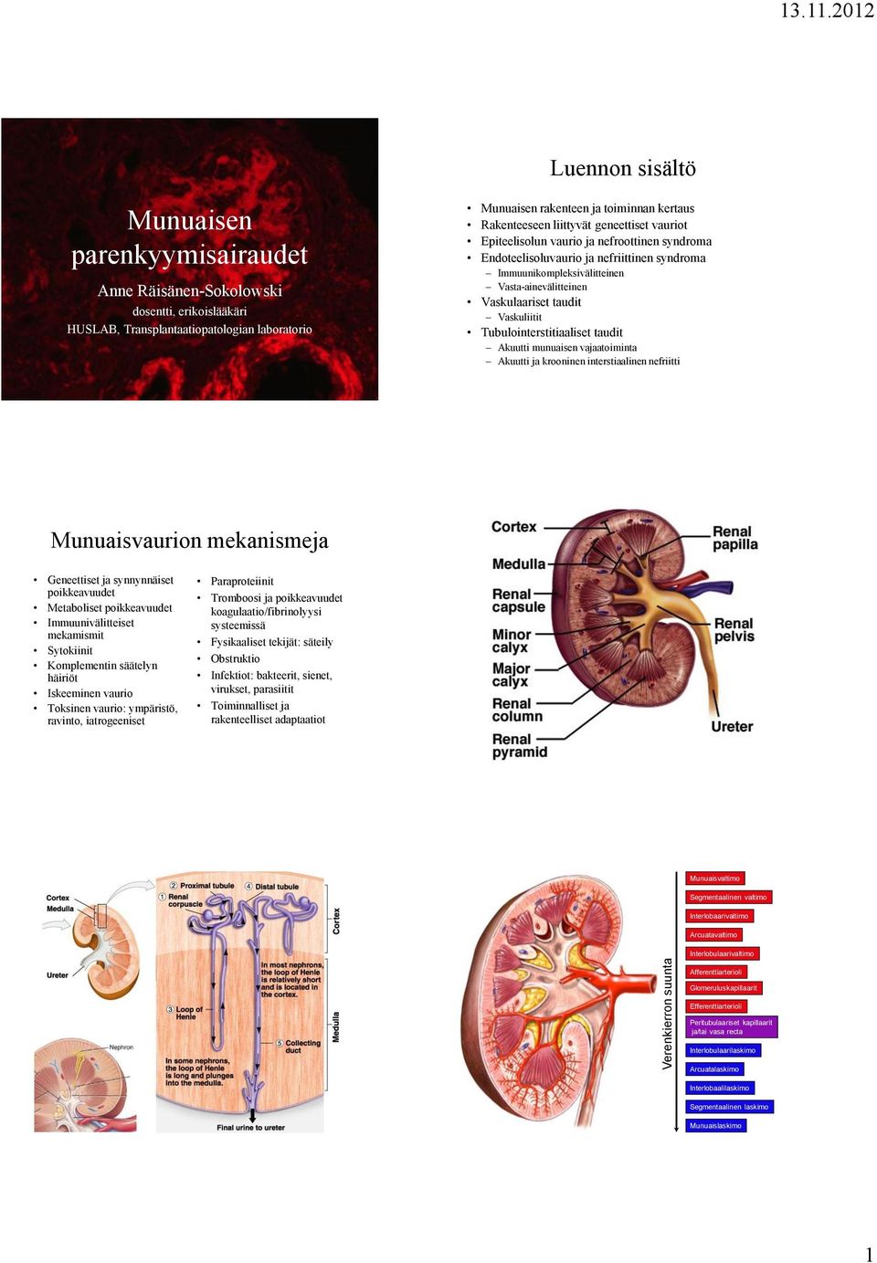 Rakenteeseen liittyvät geneettiset vauriot Epiteelisolun vaurio ja nefroottinen syndroma Endoteelisoluvaurio ja nefriittinen syndroma Immuunikompleksivälitteinen Vasta-ainevälitteinen Vaskulaariset