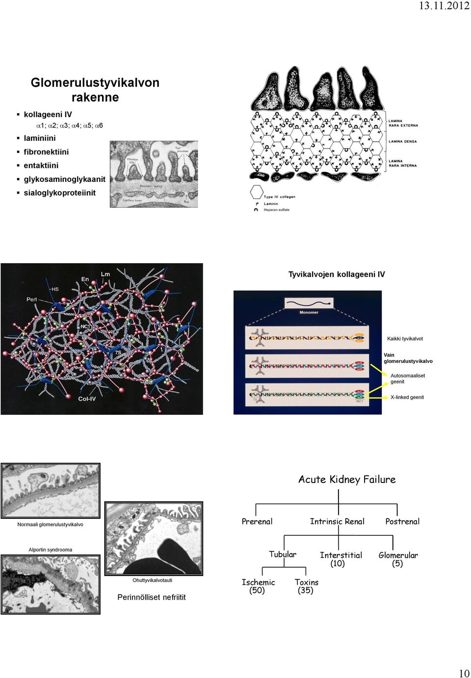 Autosomaaliset geenit X-linked geenit Acute Kidney Failure Normaali glomerulustyvikalvo Prerenal Intrinsic Renal