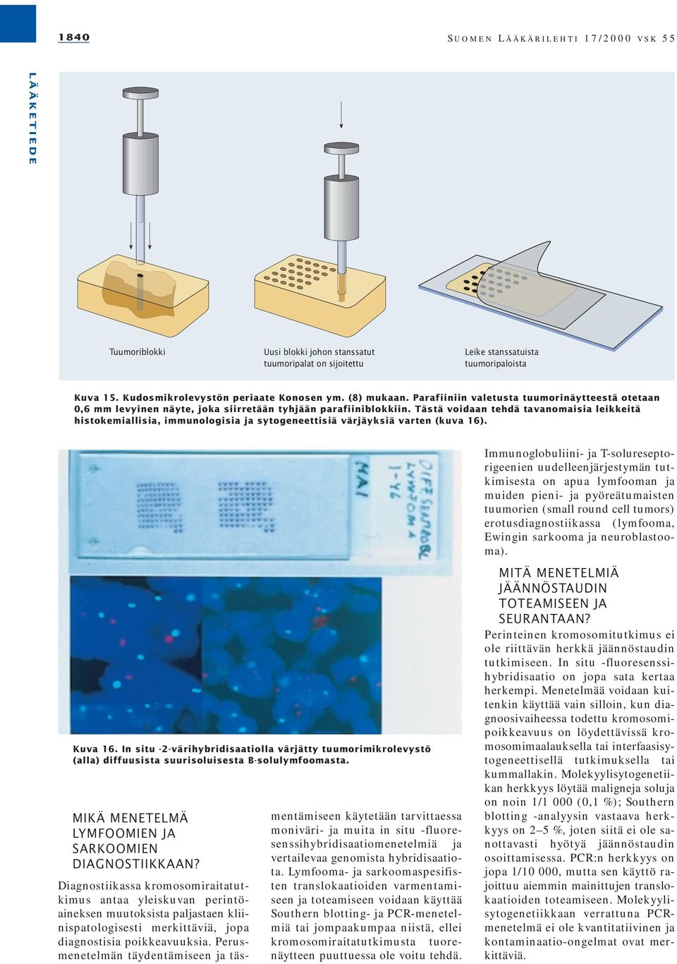 Tästä voidaan tehdä tavanomaisia leikkeitä histokemiallisia, immunologisia ja sytogeneettisiä värjäyksiä varten (kuva 16). Kuva 16.