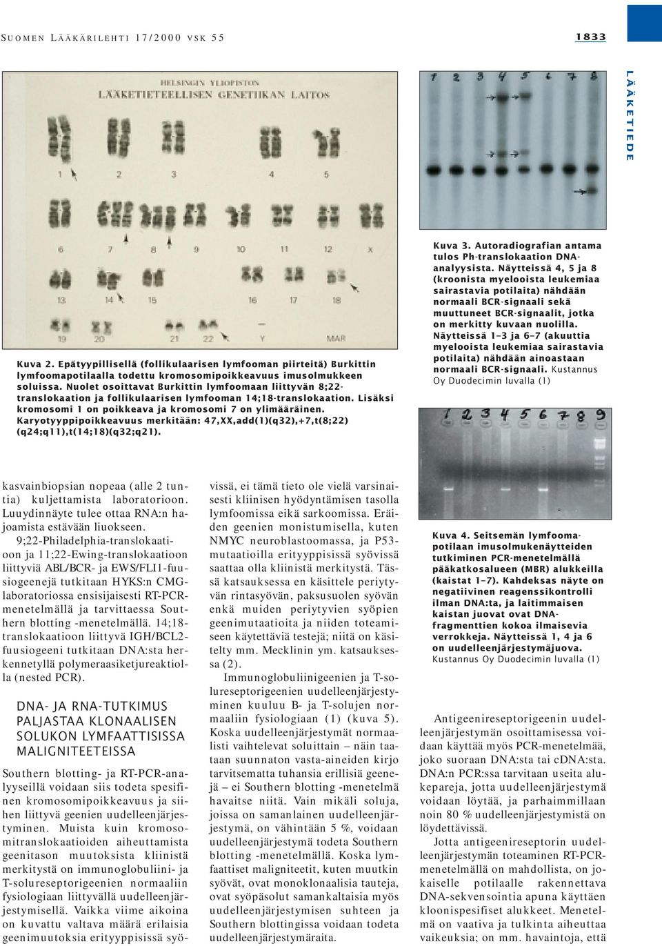 Karyotyyppipoikkeavuus merkitään: 47,XX,add(1)(q32),+7,t(8;22) (q24;q11),t(14;18)(q32;q21). Kuva 3. Autoradiografian antama tulos Ph-translokaation DNAanalyysista.