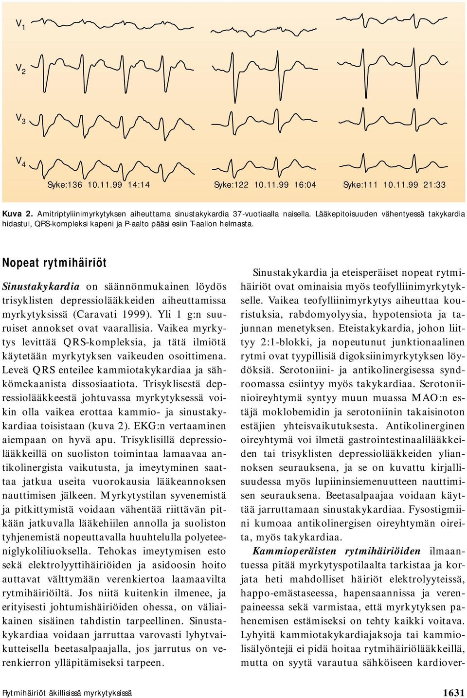 Nopeat rytmihäiriöt Sinustakykardia on säännönmukainen löydös trisyklisten depressiolääkkeiden aiheuttamissa myrkytyksissä (Caravati 1999). Yli 1 g:n suuruiset annokset ovat vaarallisia.