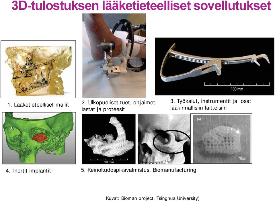 Ulkopuoliset tuet, ohjaimet, lastat ja proteesit 3.