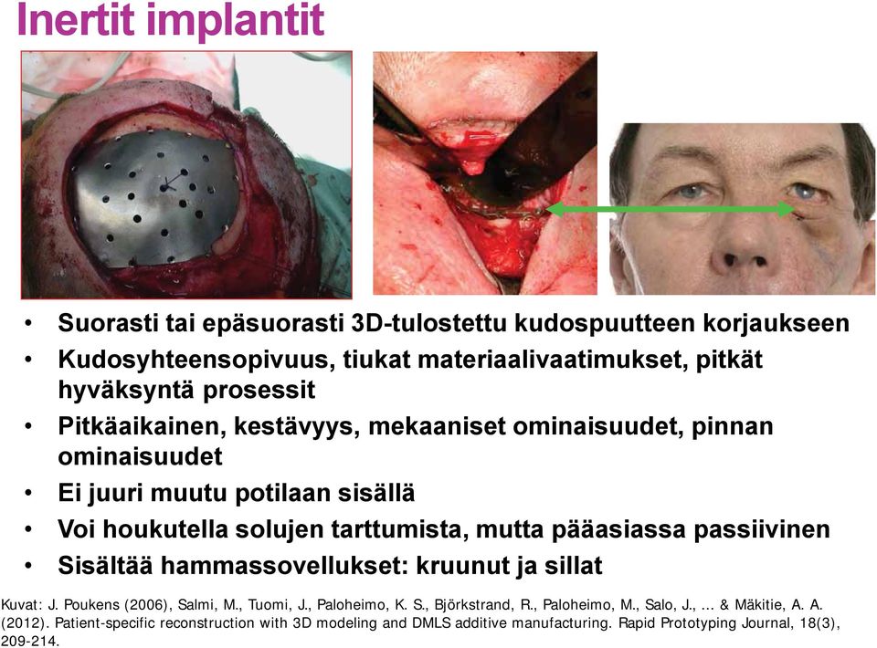 pääasiassa passiivinen Sisältää hammassovellukset: kruunut ja sillat Kuvat: J. Poukens (2006), Salmi, M., Tuomi, J., Paloheimo, K. S., Björkstrand, R.