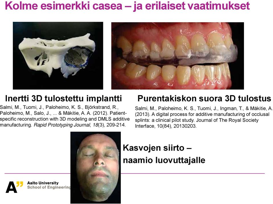 Rapid Prototyping Journal, 18(3), 209-214. Purentakiskon suora 3D tulostus Salmi, M., Paloheimo, K. S., Tuomi, J., Ingman, T., & Mäkitie, A. (2013).