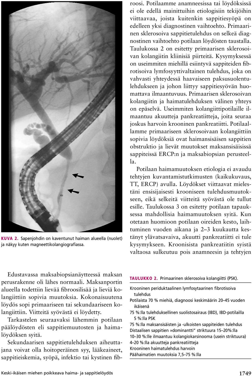 Viitteitä syövästä ei löydetty. Tarkastelen seuraavaksi lähemmin potilaan päälöydösten eli sappitiemuutosten ja haimalöydöksen syitä.