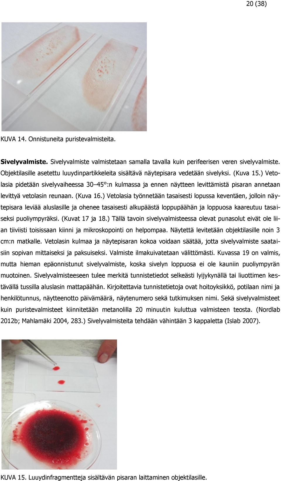 ) Vetolasia pidetään sivelyvaiheessa 30 45 :n kulmassa ja ennen näytteen levittämistä pisaran annetaan levittyä vetolasin reunaan. (Kuva 16.