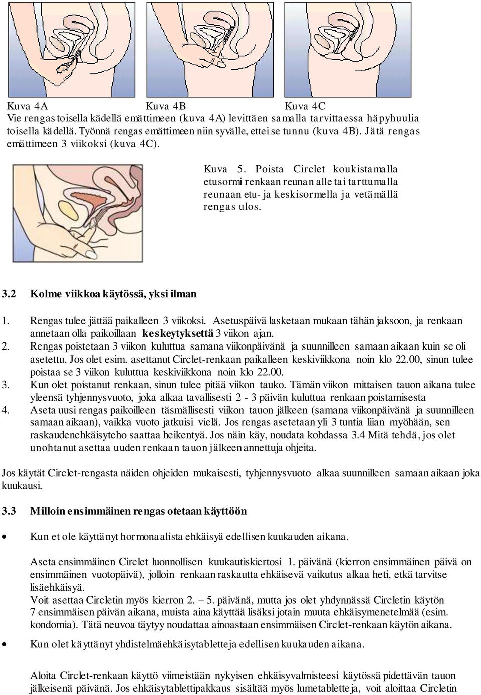 Rengas tulee jättää paikalleen 3 viikoksi. Asetuspäivä lasketaan mukaan tähän jaksoon, ja renkaan annetaan olla paikoillaan keskeytyksettä 3 viikon ajan. 2.