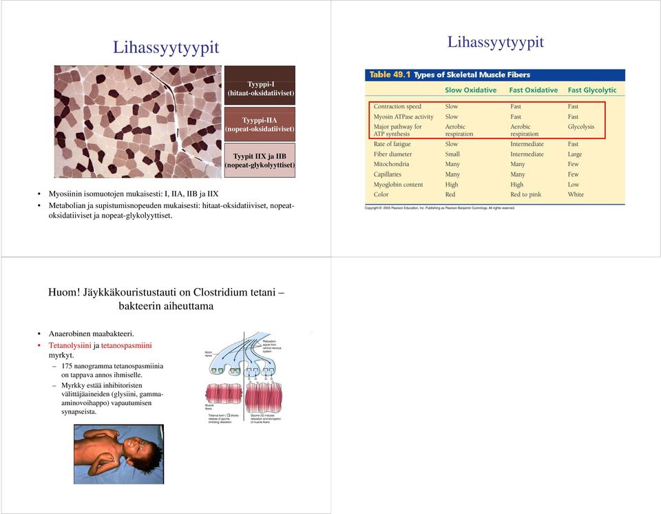 nopeat-glykolyyttiset. Huom! Jäykkäkouristustauti on Clostridium tetani bakteerin aiheuttama Anaerobinen maabakteeri.