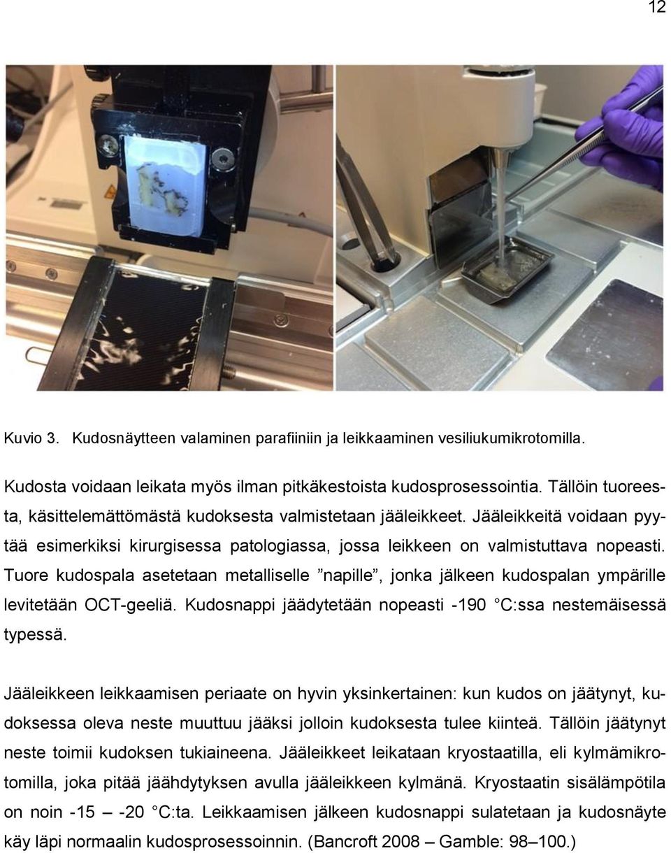 Tuore kudospala asetetaan metalliselle napille, jonka jälkeen kudospalan ympärille levitetään OCT-geeliä. Kudosnappi jäädytetään nopeasti -190 C:ssa nestemäisessä typessä.