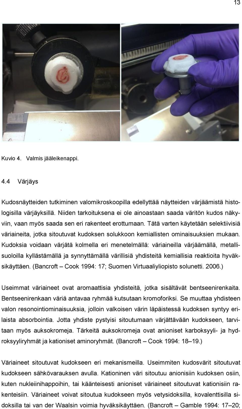 Tätä varten käytetään selektiivisiä väriaineita, jotka sitoutuvat kudoksen solukkoon kemiallisten ominaisuuksien mukaan.