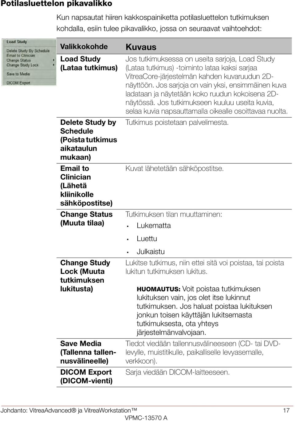 Load Study (Lataa tutkimus) -toiminto lataa kaksi sarjaa VitreaCore-järjestelmän kahden kuvaruudun 2Dnäyttöön.