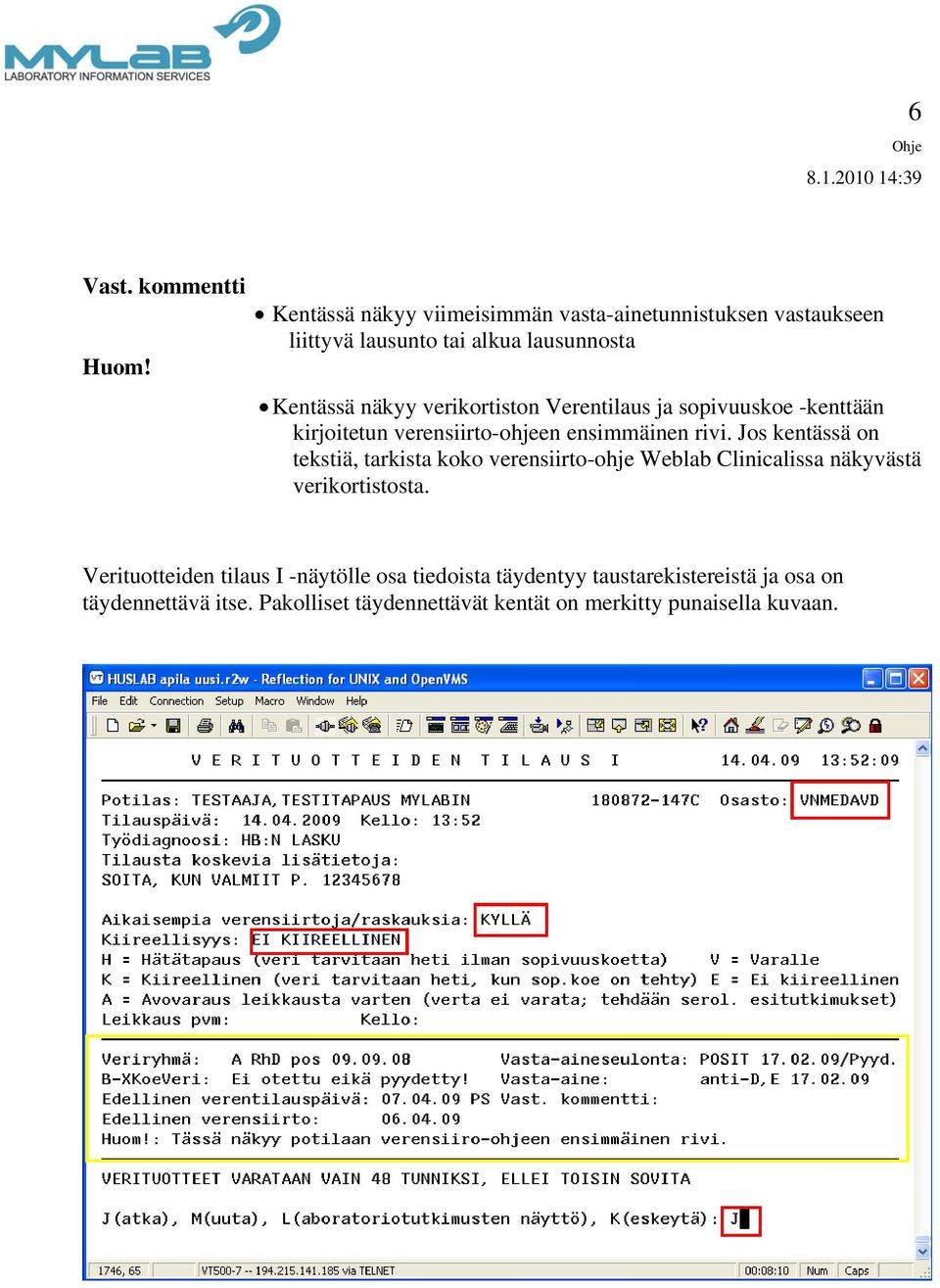 verikortiston Verentilaus ja sopivuuskoe -kenttään kirjoitetun verensiirto-ohjeen ensimmäinen rivi.