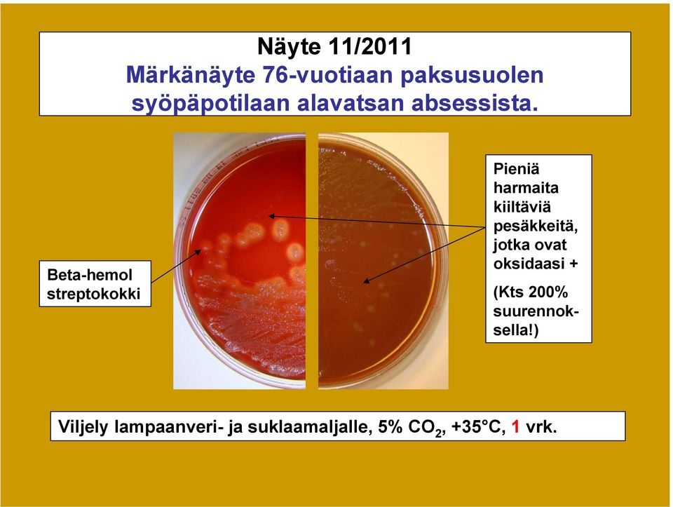 Beta-hemol streptokokki Pieniä harmaita kiiltäviä pesäkkeitä,