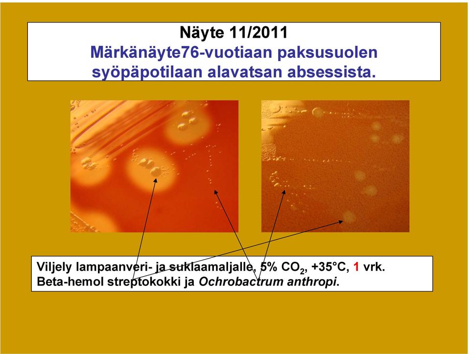 Viljely lampaanveri- ja suklaamaljalle, 5% CO 2,